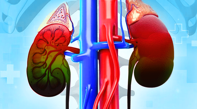 10 Essential Steps to Safeguard Your Kidney Health